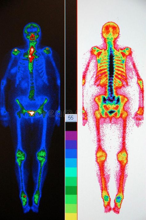 Nuclear Medicine Technologist Aesthetic, Nuclear Medicine Technologist, Nuclear Magnetic Resonance, Body Scan, Pet Scan, Medical Student Motivation, Nuclear Medicine, Diagnostic Imaging, Medical School Inspiration