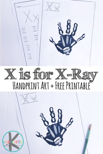 X Ray Craft, Letter X Craft For Preschoolers, Hand Xray, Letter X Crafts, Hand Art Projects, Alphabet For Toddlers, Practice Tracing, Alphabet Letter Crafts, Free Preschool Printables