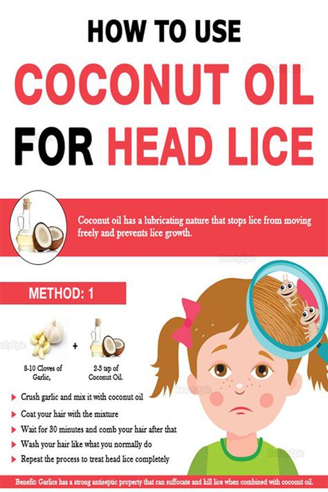 Getting Rid Of Nits, Lice Remedies, Hair Lice, Lice Removal, Diy Coconut Oil, Head Louse, Body Hair Removal, Unwanted Hair Removal, Handmade Beauty Products