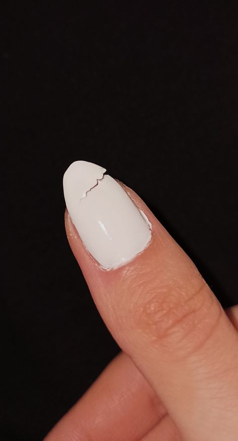 nail
broken nail
nails
nail art
nailart
sad Nails Snap, Neymar Hot, Cute Relationship Pictures, Broken Nails, Ginger Hair Color, Nail Pictures, Snap Streak, Casual Indian Fashion, Broken White