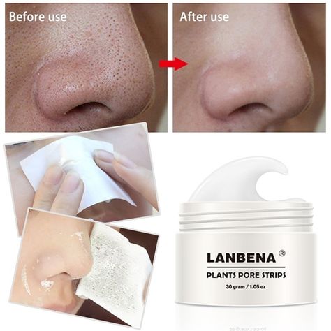 Nose Peeling, Nose Pore Strips, Black Head Remover Mask, Nose Pores, Blackhead Mask, Peeling Mask, Pore Strips, Nose Mask, Get Rid Of Blackheads