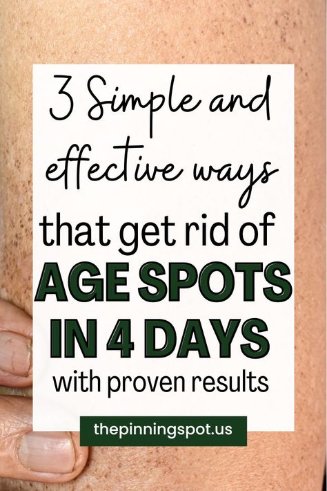 healthy nails remedies Removing Age Spots, Remove Age Spots, Age Spot Removal, Age Spot, Dark Spots On Face, Brown Spots On Face, Dark Spots On Skin, Spots On Face, Saggy Skin