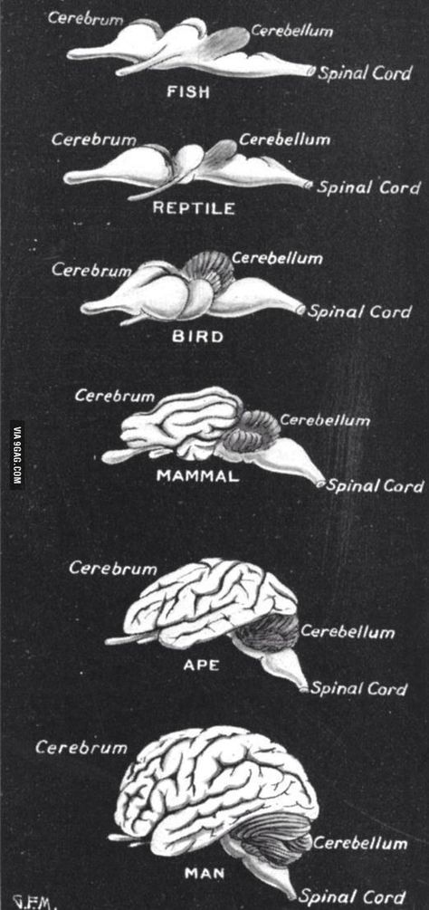 Science Rules, Brain Anatomy, Ap Biology, Science Nerd, Brain Science, Animal Science, Medical Anatomy, Human Brain, Body Systems