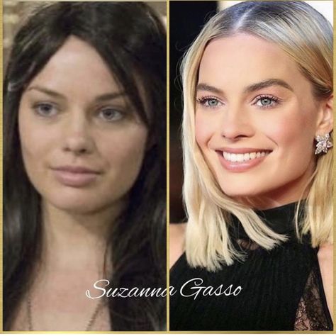 Before and after Margot Robbie Face Transformation, Celebrity Children, British Celebrities, Celebrity Plastic Surgery, Celebrities Before And After, Long Hair Tutorial, Nose Job, Movie Sets, Medium Hair Cuts