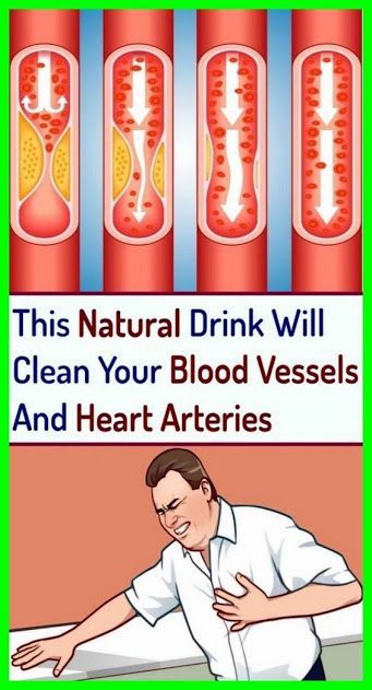 Board name Freezing Lemons, Heart Arteries, Clogged Arteries, Coconut Health Benefits, Benefits Of Coconut Oil, Natural Drinks, Health Advice, Blood Vessels, Healthy Tips