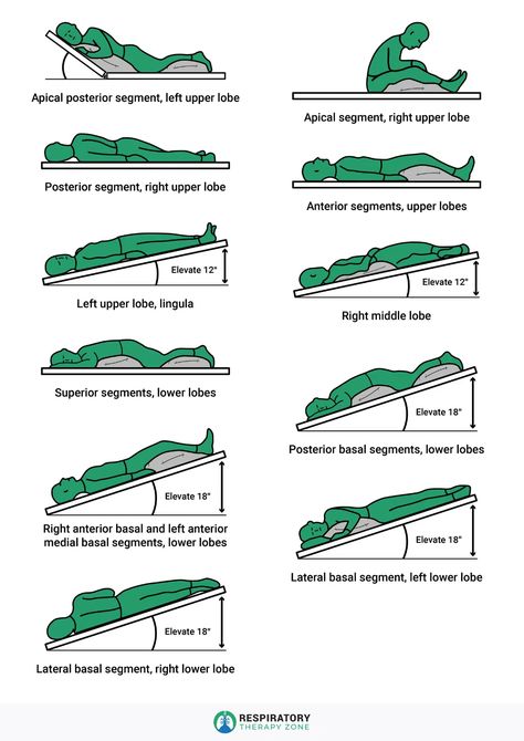 Postural Drainage Positions and Chest Physical Therapy (CPT) Physical Therapy Tips, Physical Therapy Student Study, Physical Therapy Assistant Student, Postural Drainage, Physiotherapy Student, Respiratory Therapy Student, Pt School, Exercise Therapy, Physical Therapy Student