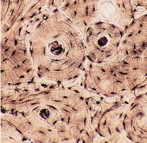 Connective Tissue - Compact Bone Connective Tissue Drawing, Cancellous Bone, Loose Connective Tissue, Types Of Blood Cells, Hyaline Cartilage, Bone Tissue, Histology Slides, Types Of Bones, Anatomy Bones