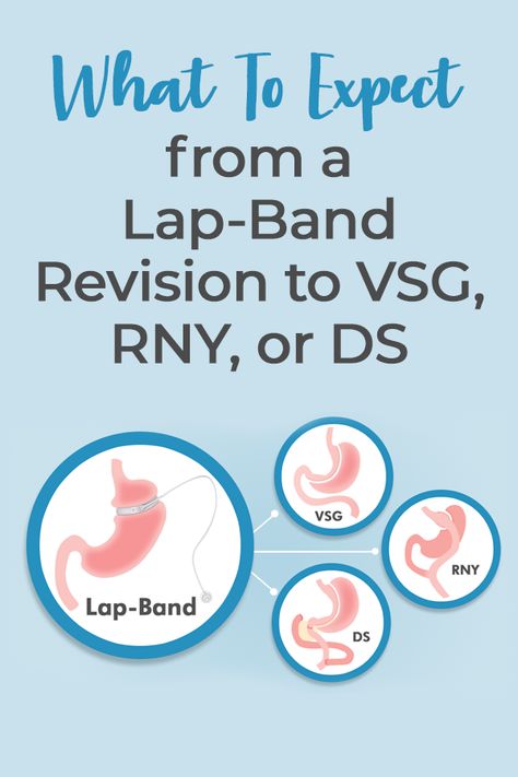 Stomach Swelling, Lap Band, Sleeve Gastrectomy, Nutritional Deficiencies, Gastric Bypass, Scar Tissue, After Surgery, Medical Problems, Blood Test