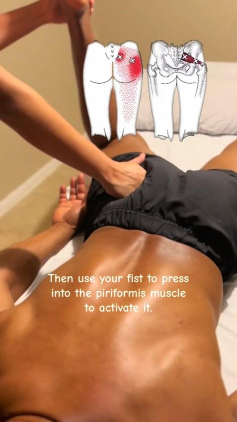 Your solution to hip pain Relaxing Massage Techniques, Sciatica Massage, Foot Massage Techniques, Full Body Massage Techniques, Sports Massage Therapy, Massage Therapy Business, Body Massage Techniques, Bolesti Chrbta, Massage Therapy Techniques