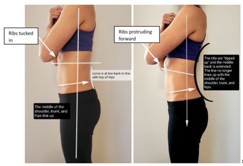 Postpartum Rib Flare, Exercises For Rib Flare, Rib Flare Correction, Flared Rib Cage, Flared Ribs Before And After, Rib Flare Before And After, Rib Flare Exercises, Flared Ribs, Better Posture Exercises