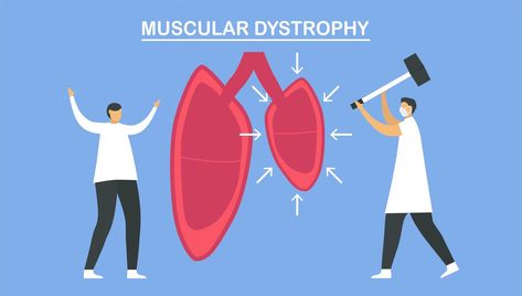 Muscular dystrophy is diseases Duchenne Muscular Dystrophy, Muscular Dystrophy, Art Room, Disease, Vector Art, For Free, Clip Art, Quick Saves, Art