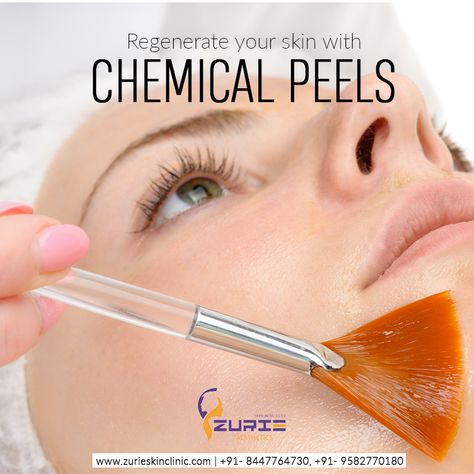 Facial Steps, Facial Before And After, Website Quotes, Facial Benefits, Prescription Pad, Quotes For Business, Ivf Clinic, Chemical Peels, Aesthetic Skincare