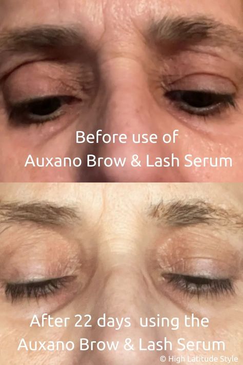 High Latitude Style This Auxano Brow and Lash serum review includes my experience with the product, before and after photos to show the hair growth, price-performance ratio. The post Auxano Brow and Lash Serum Review appeared first on High Latitude Style. Grow Eyebrows Faster, Brow Hacks, Brow And Lash, 60 Year Old Woman, Grow Lashes, How To Grow Eyebrows, Lash Growth, Liver Detoxification, Full Brows