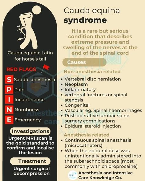 Cauda Equina, Spinal Fusion, Disk Herniation, Mri Scan, Medical School Essentials, Ehlers Danlos, Medical Anatomy, Ehlers Danlos Syndrome, Emergency Care