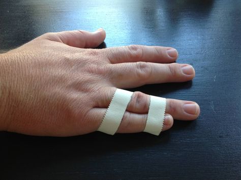 Ring fingers and pinky fingers should be buddy taped together Jammed Finger, Finger Injury, Broken Finger, Finger Exercises, Pinky Finger, Kinesiology Taping, Hand Therapy, Natural Pain Relief, Two Fingers