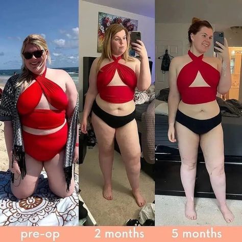 Healthy Weight Loss | Remedies New (@remedies_new) • Instagram photos and videos Weight Loose Tips For Women, Before After Body, Body Recomposition, Before And After Fitness, Weight Loose Tips, Military Workout, Body Transformations, Weight Transformation, Maternity Chic