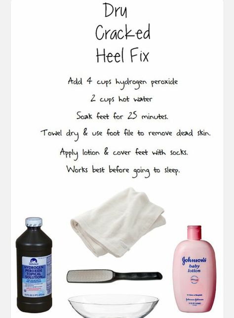 DIY how to get rid of cracked feet Dry Cracked Heels, Cracked Heel, Foot Soak, Cracked Heels, Beauty Remedies, Homemade Beauty Products, Foot Care, Health And Beauty Tips, Beauty Ideas