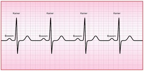 Hartritme (Hf) Normal Ecg, Medical Stickers, Customer Lifetime Value, Heart Monitor, Dancing Videos, Medical Imaging, New Amsterdam, Discreet Tattoos, Medical Students