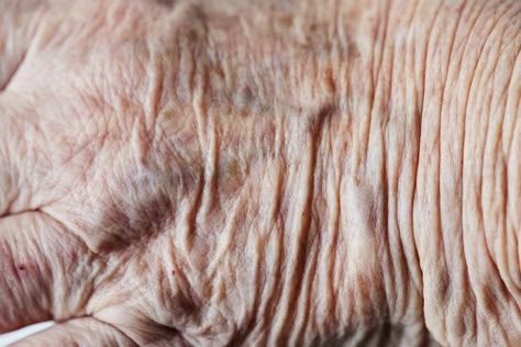 Skin Folds, Old Skin, Wrinkles Photography, Wrinkles Art, Human Skin Texture, Wrinkles Hands, Golden Life, Wrinkled Skin, A Level Art