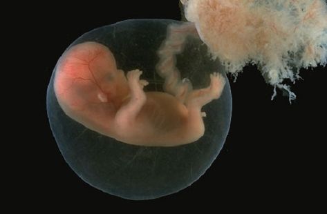 New Study Shows Unborn Babies Can Recognize Faces While Still in the Womb Rug Rats, Pregnancy First Trimester, Pregnancy Week, Saving For Baby, Fetal Development, Unborn Baby, Trimesters Of Pregnancy, First Trimester, Baby Development