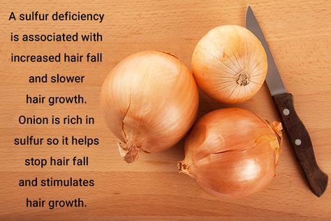 significance of onions in hair growth and repair Olive Oil For Hair Growth, Garlic For Hair Growth, Olive Oil For Hair, Garlic And Olive Oil, Slow Hair Growth, Olive Oil Hair, Garlic Benefits, Androgenetic Alopecia, Oil For Hair Growth