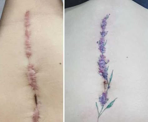 People Tattoo, Becoming Famous, Tattoo Over Scar, Mastectomy Tattoo, Scar Cover Up, Tattoos To Cover Scars, Full Tattoo, Scar Tattoo, Beautiful Flower Tattoos