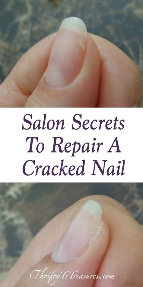 Cracked Nails, Broken Nails, Nail Repair, How To Grow Nails, Nail Care Tips, Hair Hoco, Homecoming Hair, Nail Fungus, Nail Health