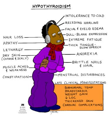 HYPOTHYROIDISM      HYPERTHYROIDISM         Decreased T3 and T4      Increased T3 and T4         Early Signs   1.          We... Nursing Mnemonics, Nursing Student Tips, Surgical Nursing, Medical Surgical Nursing, Nursing School Survival, Fundamentals Of Nursing, Nursing School Studying, Nursing School Tips, Nursing School Notes