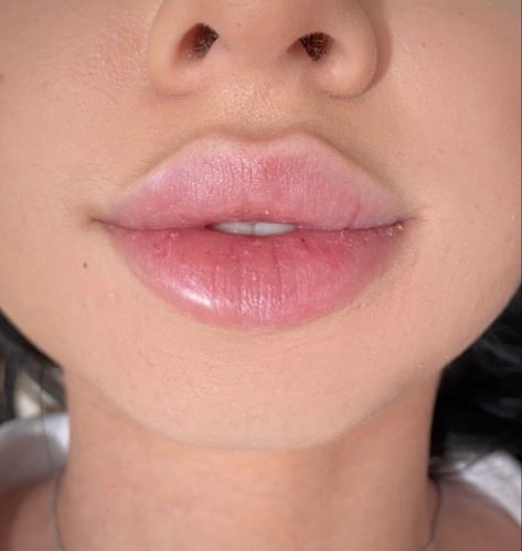 Pillow Lips, Big Lips Natural, Flawless Face Makeup, Lips Inspiration, Wax Roller, Botox Lips, Facial Contouring, Lip Augmentation, Makeup Accesories