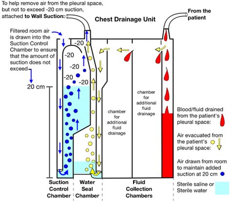 Nursing Skills, Nurse Teaching, Nursing Information, Chest Tube, Nursing Mnemonics, Medical Surgical Nursing, Nursing School Survival, Critical Care Nursing, Respiratory Therapy