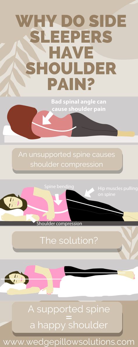 Why do side sleepers have shoulder pain Best Position To Sleep, Sore Neck And Shoulders, Rotator Cuff Surgery, Sleeping Pose, Sore Shoulder, Learn Yoga Poses, Sore Neck, Shoulder Pain Relief, Shoulder Surgery