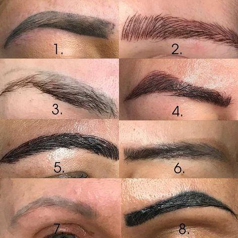 Bad Eyebrow Tattoo, Bad Microblading, Tattoo Correction, Permanent Makeup Removal, Eyebrow Tattoo Removal, Tattoos Gone Wrong, Eyebrows Tattoo, Micro Blading, Bad Eyebrows