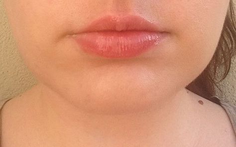 City Lips Review City Lips Before And After, City Lips, Collagen Peptides, Lip Plumper, Hyaluronic Acid, Lifestyle Blog, Cruelty Free, Plant Based, Lips