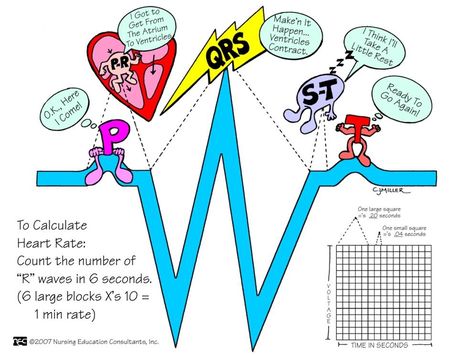 EKG                                                                                                                                                      More Post Conference Nursing Ideas, Ccrn Prep, Cardio Nursing, Medic School, Medical Learning, Shiny Teeth, Paramedic Student, Nursing Flashcards, Nursing Instructor