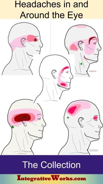 Headache Behind Eyes, Forward Head Posture Exercises, Blood Sugar Solution, Throbbing Headache, Neck And Shoulder Muscles, Eye Pain, Forward Head Posture, Head Pain, Blood Sugar Diet