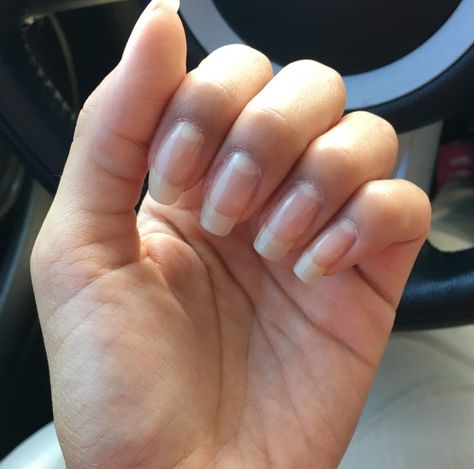 Strong Nails Natural, Healthy Long Nails, Habit Motivation, Natural Nail Growth, Fingernail Health, Grow Long Nails, White Toes Nail, Nail Remedies, Toe Nail Fungus