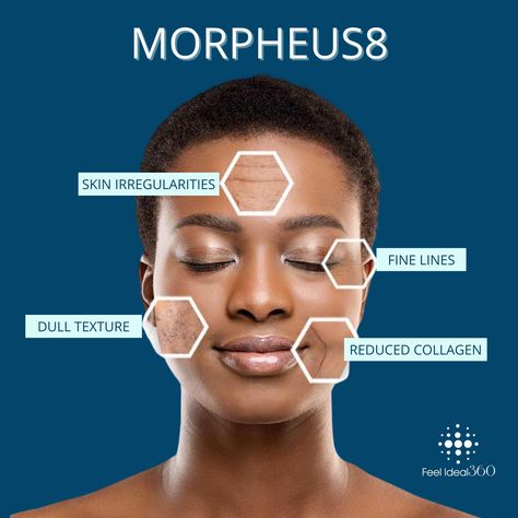 Skin Theory, Morpheus 8, Rf Microneedling, Laser Facial, Skin Facts, Skin Aesthetics, Healing Waters, Aesthetic Medicine, Color Blind