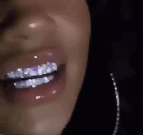 Girls With Grills, Girl Grillz, Pretty Teeth, Grillz Teeth, Diamond Grillz, Diamond Teeth, Icy Girl, Grills Teeth, Tooth Gem