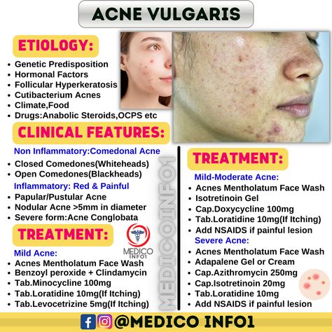 Medico Info1 Nodular Acne, Comedonal Acne, Painful Acne, Moderate Acne, Mild Acne, Acne Vulgaris, Pharmacology Nursing, Severe Acne, Medical School Essentials