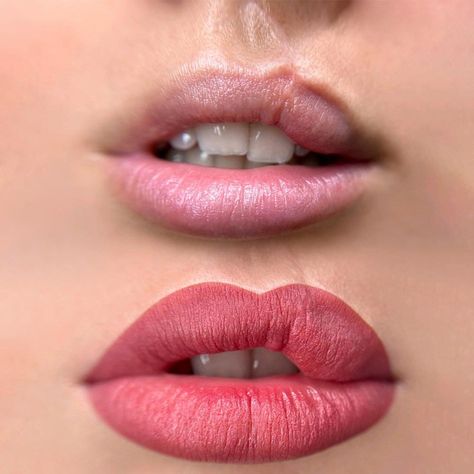 Cleft Lip Scar, Cleft Lip Tattoo Ideas, Permanent Lip Color Tattoo, Awareness Tattoo Ideas, Lipstick For Dark Lips, Lip Hyperpigmentation, Lip Tattoo Ideas, Cosmetic Lip Tattoo, Lip Color Tattoo