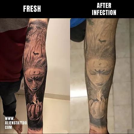 Infected Tattoo Images, mild tattoo infection, Infected tattoo before and after, infected tattoo scab, Tattoo Touch Up Before And After, Tattoo Scabbing, Tattoo Aftercare Tips, Tattoo Touch Up, Aliens Tattoo, Infected Tattoo, Black Color Hairstyles, Becoming A Tattoo Artist, Color Hairstyles