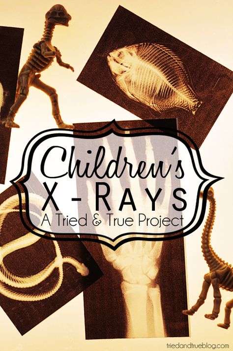 Childrens Play X-Rays : Free printables from Tried & True Child Life Specialist, Dramatic Play Preschool, Dramatic Play Centers, X Rays, Preschool Science, E Mc2, Play Centre, Homeschool Science, Dramatic Play