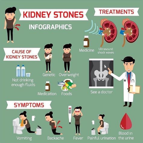 Do you believe that you are passing a kidney stone? Here is some information that you should be aware of. Kidney Pain, Kidney Stone, Kidney Health, Doctor Appointment, Neurology, Alternative Health, Health Conditions, Healthy Nutrition, Easy Workouts