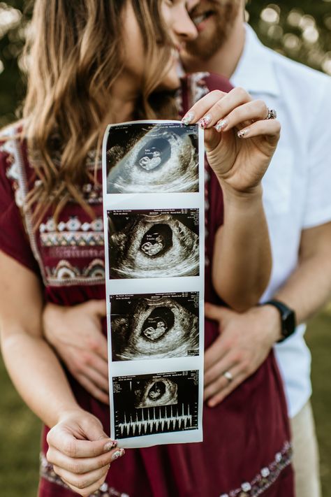 Baby announcement photo with sonogram Sonogram Picture Ideas Couple, Sonogram Photoshoot Ideas, Sonogram Maternity Photos, Sonogram Announcement Ideas, Baby Sonogram Pictures, Sonogram Photoshoot, Ultrasound Announcement Ideas, Sonogram Picture Ideas, Sonogram Announcement