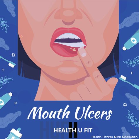 Small sores called mouth ulcers can develop on the gums, lips, tongue, inner cheeks, or roof of the mouth. They can be brought on by a variety of factors, including small wounds, hormone changes, and emotional stress. The majority of mouth ulcers heal on their own. Others could need medical attention. Oral Health, Health Problems, Roof, Medical, Lips, Healing, Health, Anime, Quick Saves