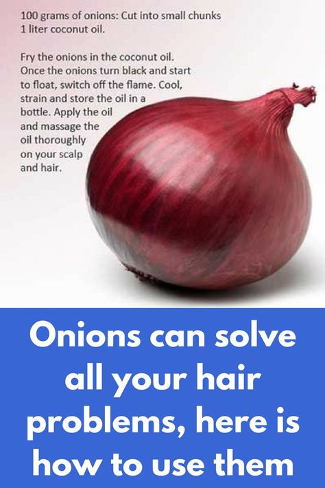 Onions can solve all your hair problems, here is how to use them 1: Onion Juice After-Wash Solution Ingredients 1 Tablespoon Onion Juice 1 Liter Warm Water Add the onion juice to the warm water. Use the mixture as the final rinse after you shampoo. This onion paste for hair can be used every alternative day. Caution: The odor of onion will be retained in your hair until … Hair Problems Solutions, Onion Water, Grey Hair Remedies, Regrow Hair Naturally, Long Hair Highlights, Onion For Hair, Onion Juice, Hair Wash, Regrow Hair