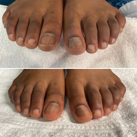 Men Pedicure, Dark Skin Nail Polish, Mens Manicure, Guys Grooming, Pedicure Designs Toenails, Pedicure Designs, Black Men Fashion, Manicure And Pedicure, Toe Nails