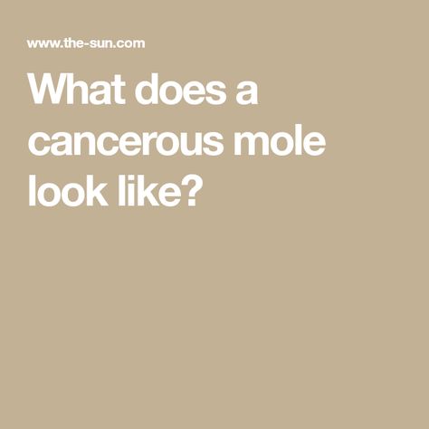 What does a cancerous mole look like? Cancerous Moles, Different Shades Of Black, The Signs, Mole, How To Know, The Uk, Signs, Skin, Health