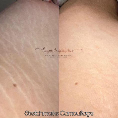 Paramedical Tattoo, Aesthetics Tattoo, Cosmetic Tattooing, Permanent Cosmetics, Cosmetic Tattoo, Redondo Beach, Permanent Makeup, Flawless Skin, Semi Permanent