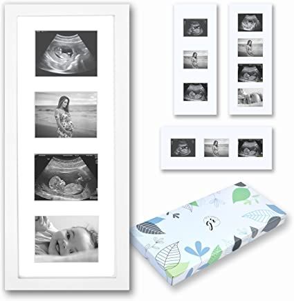 Gender Reveal Gift Ideas, 1st Time Mom, Picture Frame Layout, Baby Ultrasound Pictures, Sonogram Picture Frame, Ultrasound Picture Frame, Ultrasound Frame, Baby Sonogram, Nursery Picture Frames